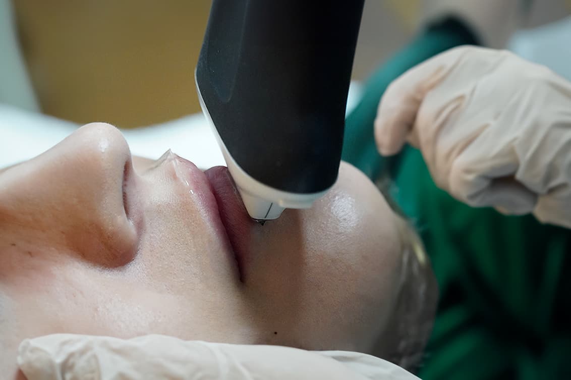 Nesai Ecógrafo en uso